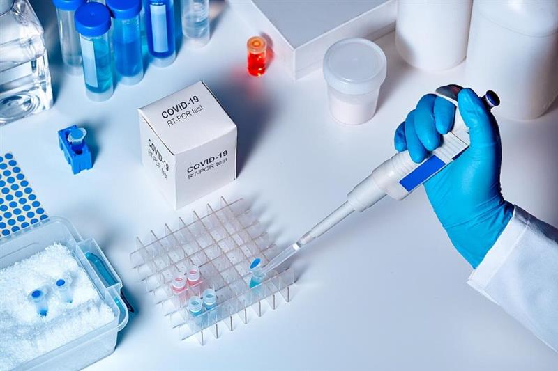  PCR test – Γεωργιάδης: Κοντά στα 50 ευρώ θα πάει η τιμή του μοριακού τεστ – Σήμερα η νέα ΚΥΑ